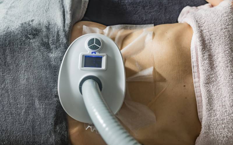 Cryolipolise : installation de la pièce sur le ventre