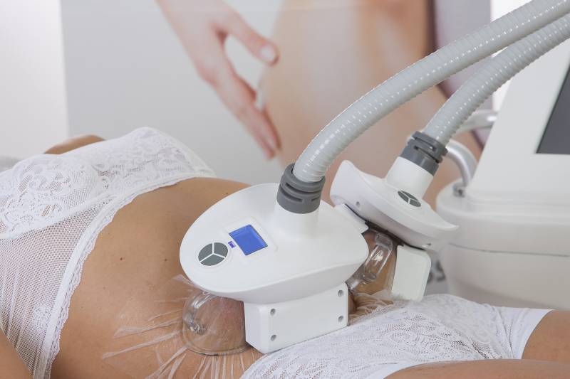 résultats visible au bout d'un mois grâce à la cryolipolyse à Balma proche de Toulouse 