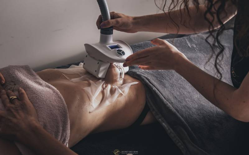 Cryolipolyse du ventre